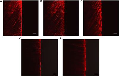 Enhancing the inhibition of dental erosion and abrasion with quercetin-encapsulated hollow mesoporous silica nanocomposites
